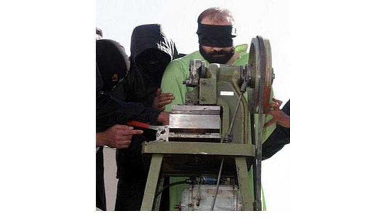 IranFingerAmputator.jpg