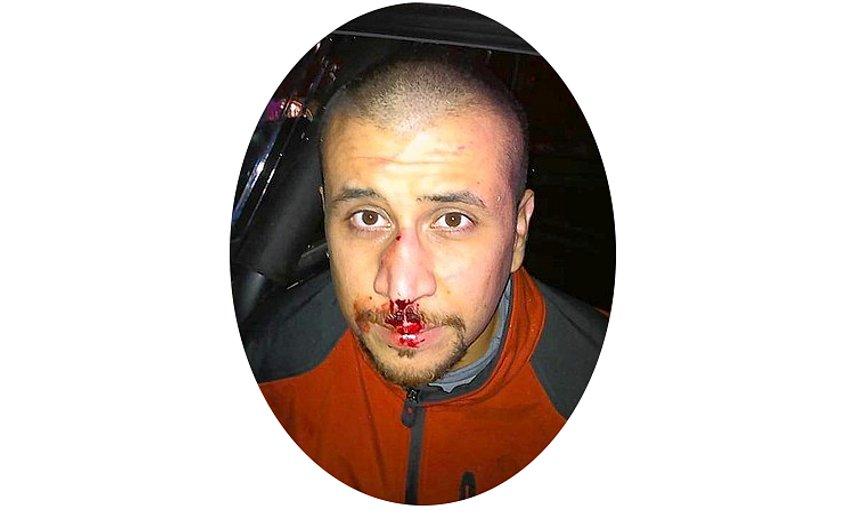 ZimmermanAfterFight.jpg